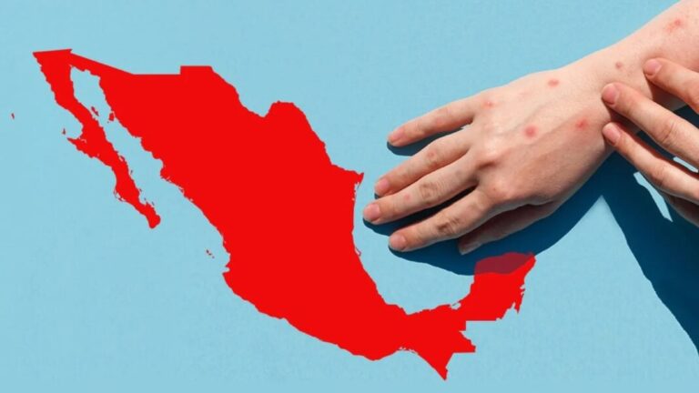 Alerta Secretaría de Salud de alza “significativa” de casos de sarampión en México